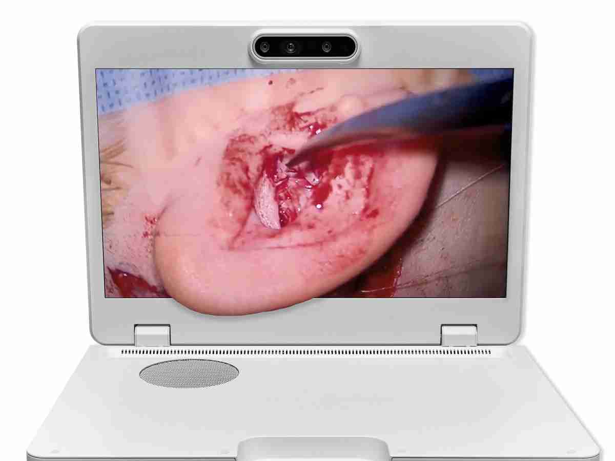 达擎之＂Heads-up 3D显微手术显示系统＂，，，整合4K裸眼3D显示及眼球追踪系统，，，具备快速追踪人眼移动位置功能，，，减轻医师长时间维持固定姿势的负担，，让医师能有更宽广清晰的3D立体视野及更舒适的姿势来执行手术。。。。